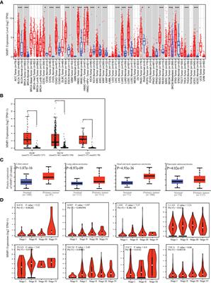 A pan-cancer analysis of the prognostic and immunological roles of matrix metalloprotease-1 (MMP1) in human tumors